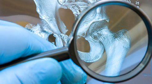 How Do They Diagnose Bone Cancer?
