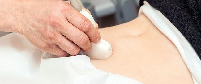 How Are Ovarian Teratomas Treated? Symptoms, Types & Diagnosis