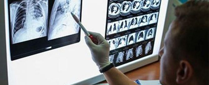 Out-of-Pocket Costs Delay Cancer Follow-Up Care, Even for the Insured