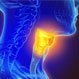What Are the Stages of Throat Cancer? Chart