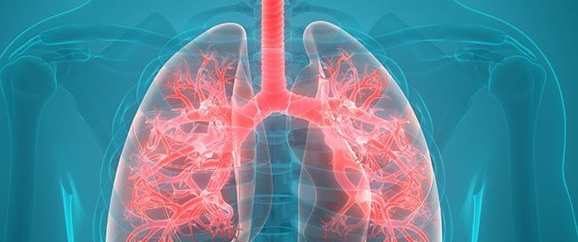 Which Lung Cancer Type is More Aggressive?