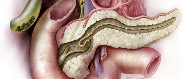 Is a Neuroendocrine Tumor the Same as Pancreatic Cancer?