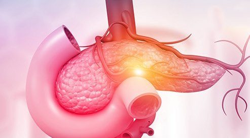 What Is the Most Common Pancreatic Neuroendocrine Tumor? Insulinomas