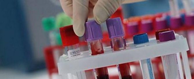 New Tests for Colon, Prostate Cancer Show Promise