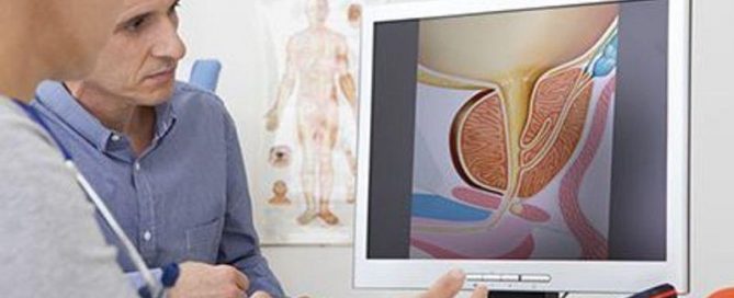 Urine Test May Spot Aggressive Prostate Cancer