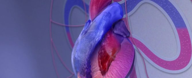 Survey: Hypertrophic cardiomyopathy patients face challenges; need educational resources