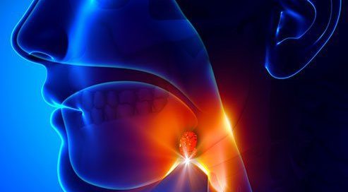 Can White Spots on the Throat Be Cancer? Other Causes, Treatment