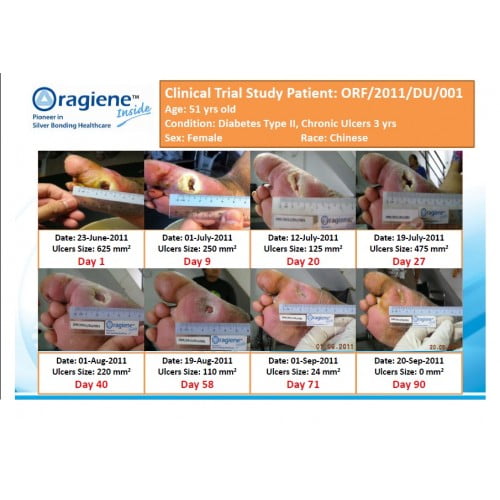 Oragiene - Diabetic Socks